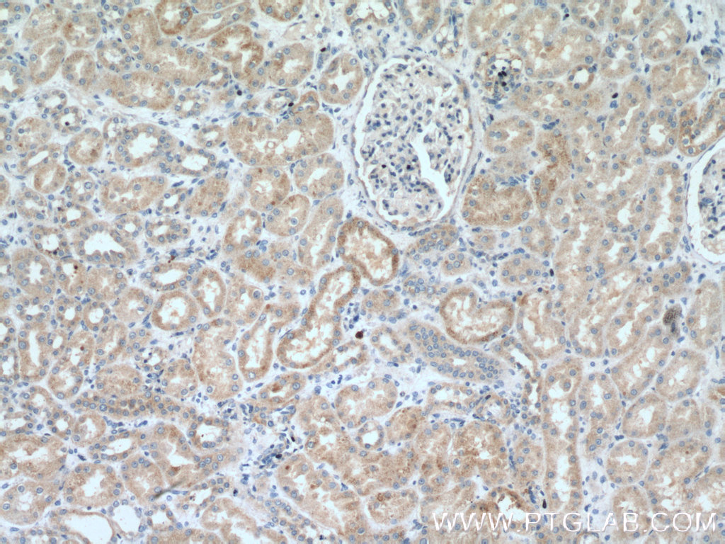 IHC staining of human kidney using 17629-1-AP