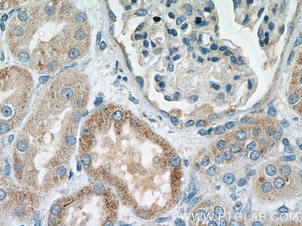 IHC staining of human kidney using 17629-1-AP