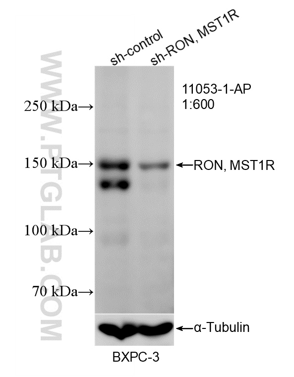 WB result of RON, MST1R antibody (11053-1-AP; 1:600; incubated at room temperature for 1.5 hours) with sh-Control and sh-RON, MST1R transfected BxPC-3 cells. WB analysis of BxPC-3 using 11053-1-AP