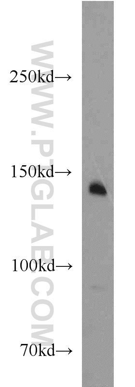 WB analysis of mouse lung using 11053-1-AP