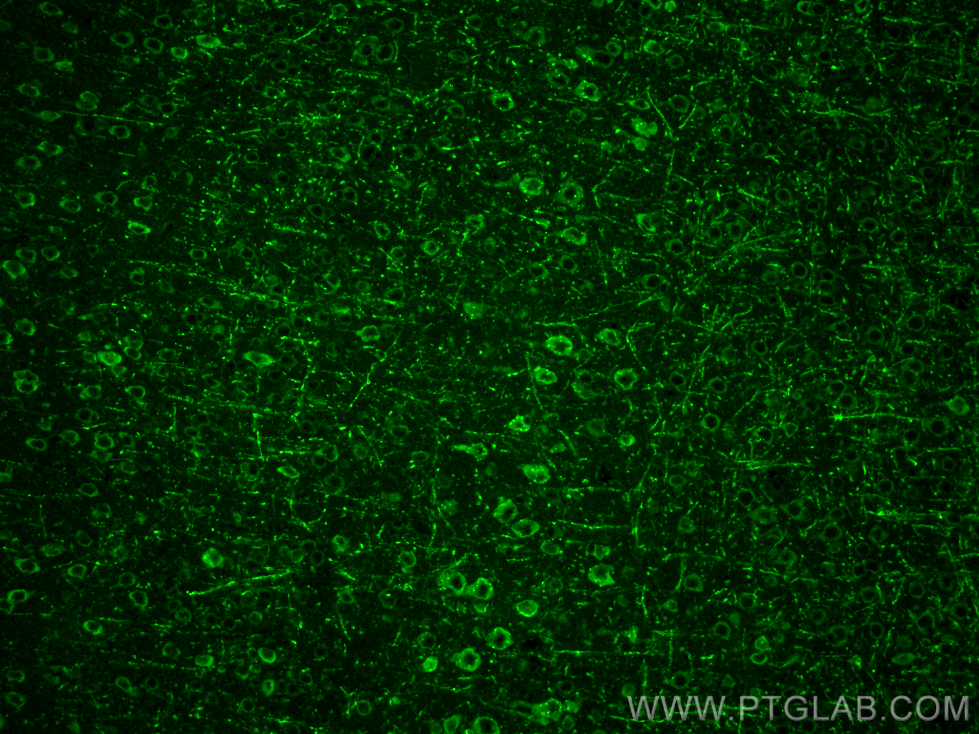 IF Staining of mouse brain using 19142-1-AP (same clone as 19142-1-PBS)