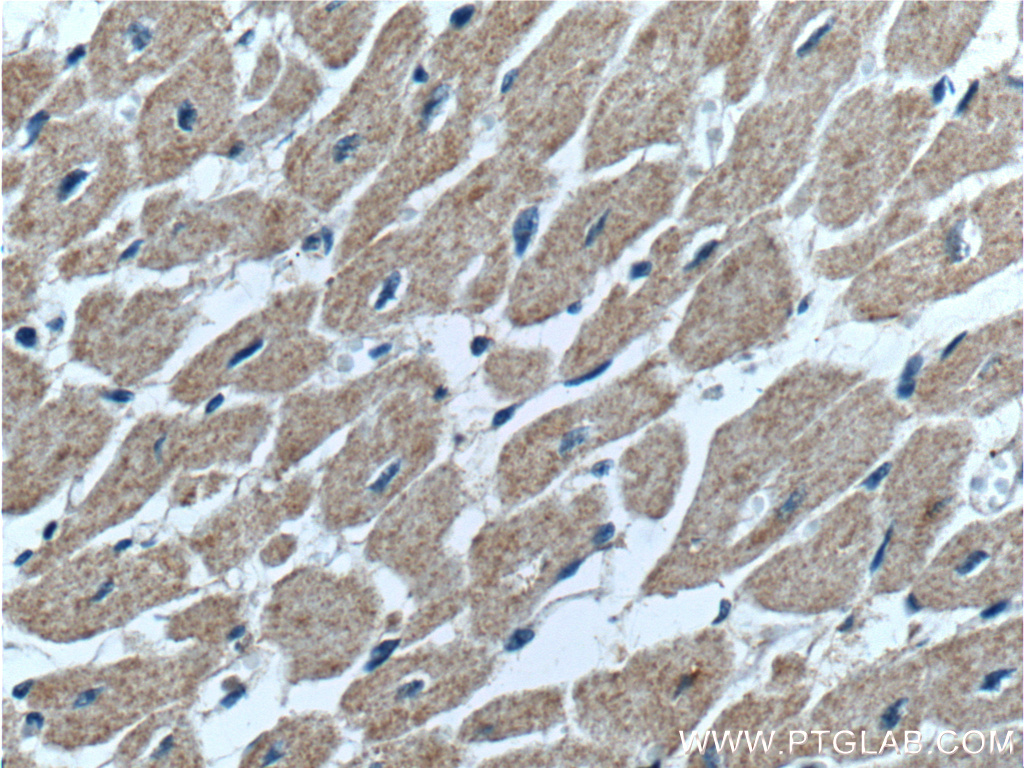 IHC staining of human heart using 19142-1-AP