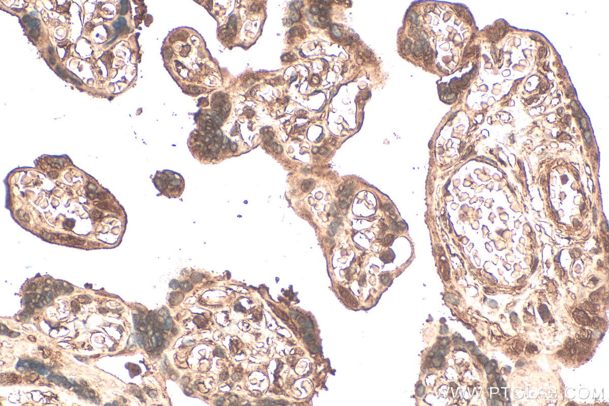 Immunohistochemical analysis of paraffin-embedded human placenta tissue slide using 68550-1-Ig (MSX2 antibody) at dilution of 1:200 (under 40x lens). Heat mediated antigen retrieval with Tris-EDTA buffer (pH 9.0). IHC staining of human placenta using 68550-1-Ig