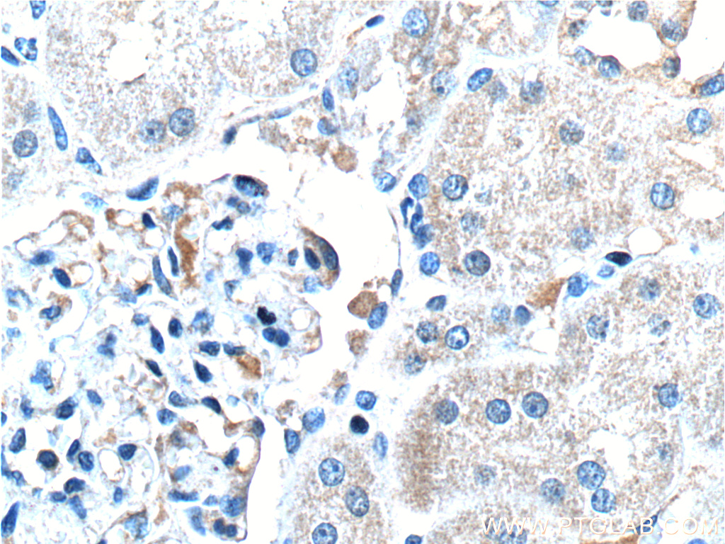 IHC staining of human kidney using 17281-1-AP