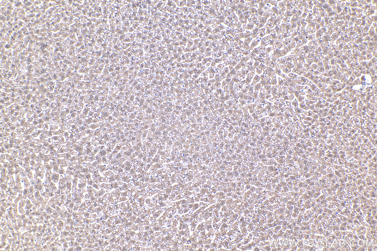 IHC staining of mouse liver using 20809-1-AP