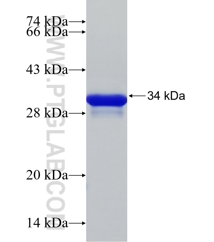MT3 fusion protein Ag33339 SDS-PAGE MT3 fusion protein Ag33339 SDS-PAGE