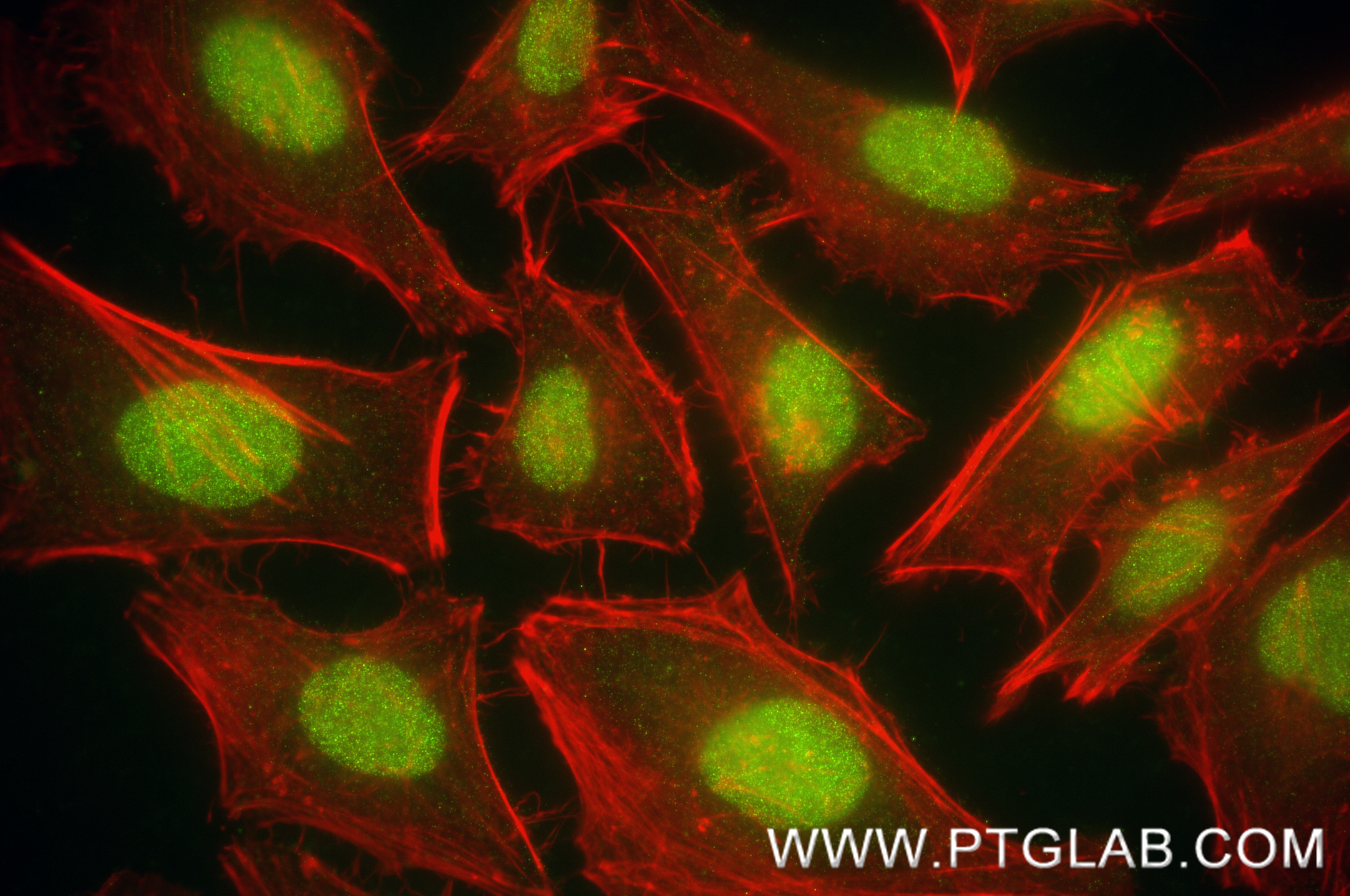 IF Staining of HeLa using 87979-1-RR (same clone as 87979-1-PBS) IF Staining of HeLa using 87979-1-RR (same clone as 87979-1-PBS)