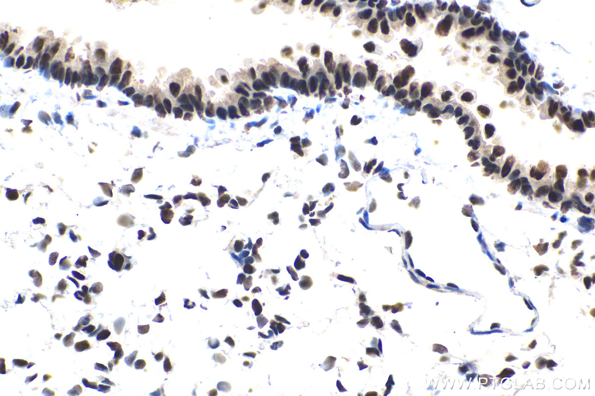 IHC staining of rat lung using 17554-1-AP