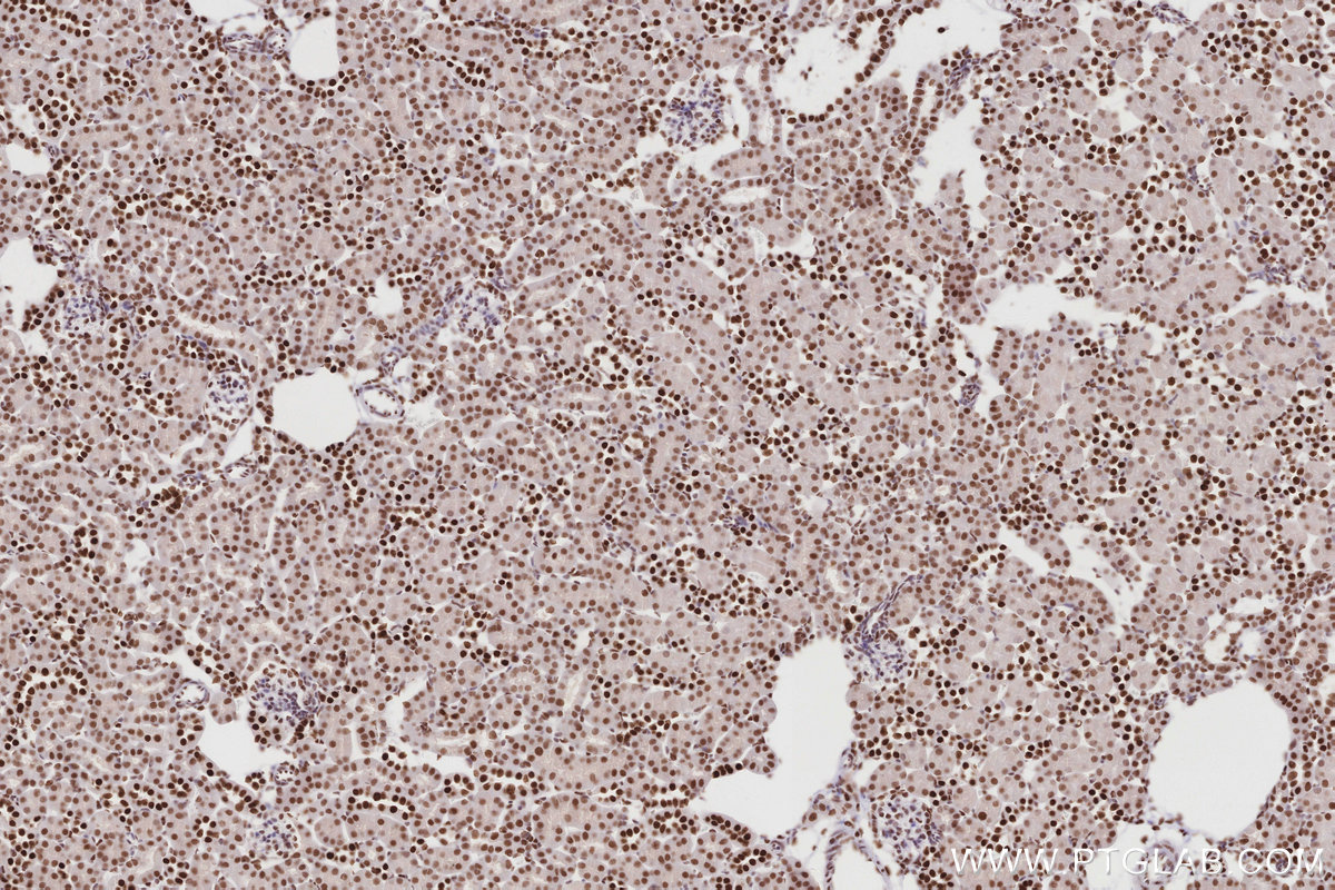 IHC staining of mouse kidney using 83042-3-RR IHC staining of mouse kidney using 83042-3-RR