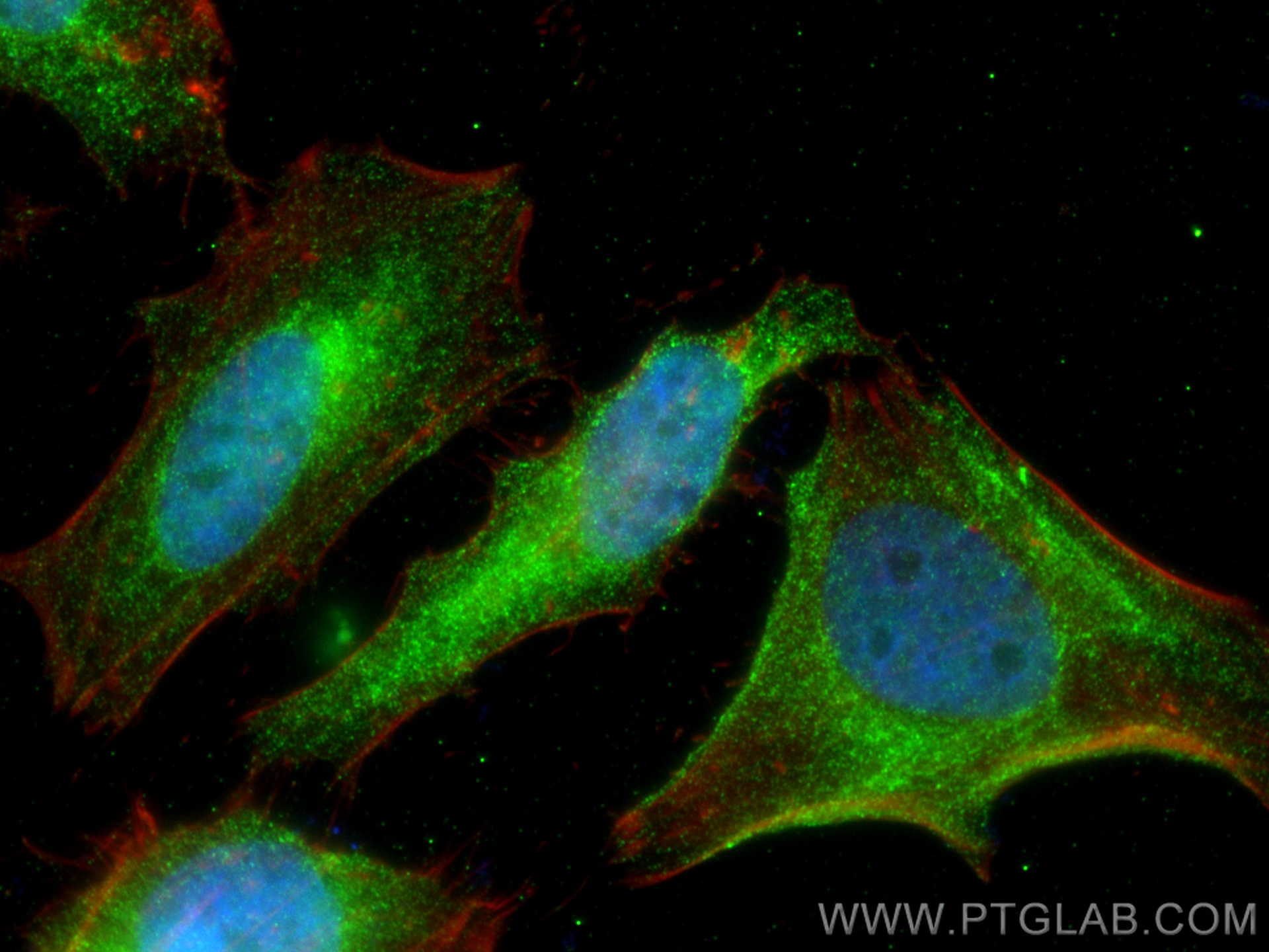 IF Staining of HeLa using 66706-1-Ig (same clone as 66706-1-PBS)