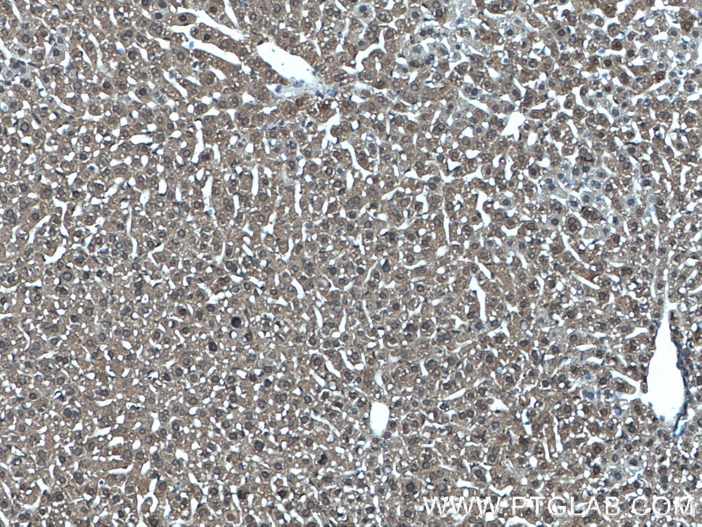 IHC staining of mouse liver using 66706-1-Ig (same clone as 66706-1-PBS)