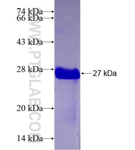 MTBP fusion protein Ag28393 SDS-PAGE
