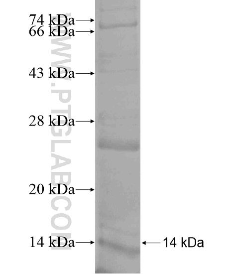 MTCH1 fusion protein Ag20078 SDS-PAGE MTCH1 fusion protein Ag20078 SDS-PAGE