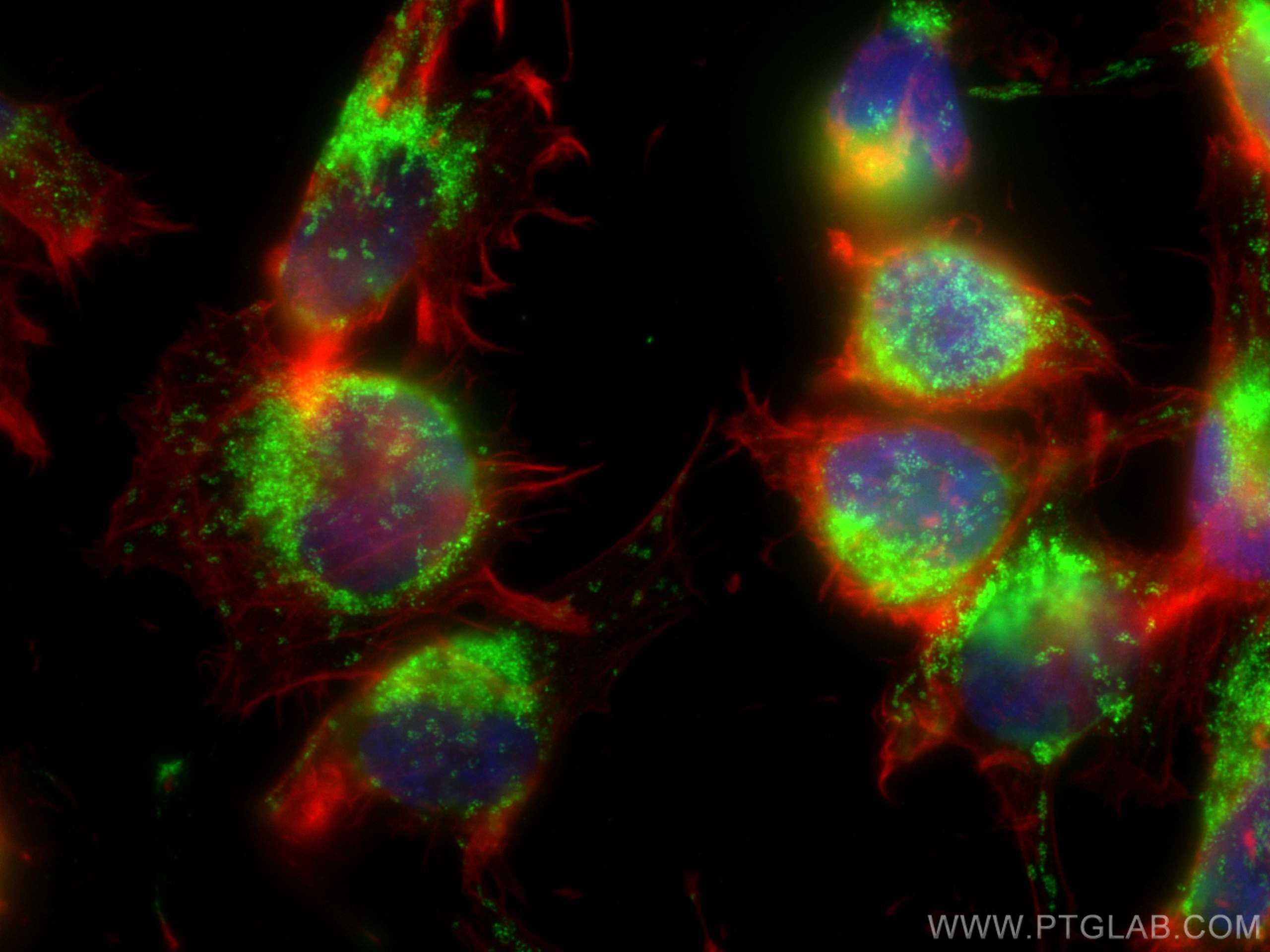 IF Staining of U-251 using 16888-1-AP