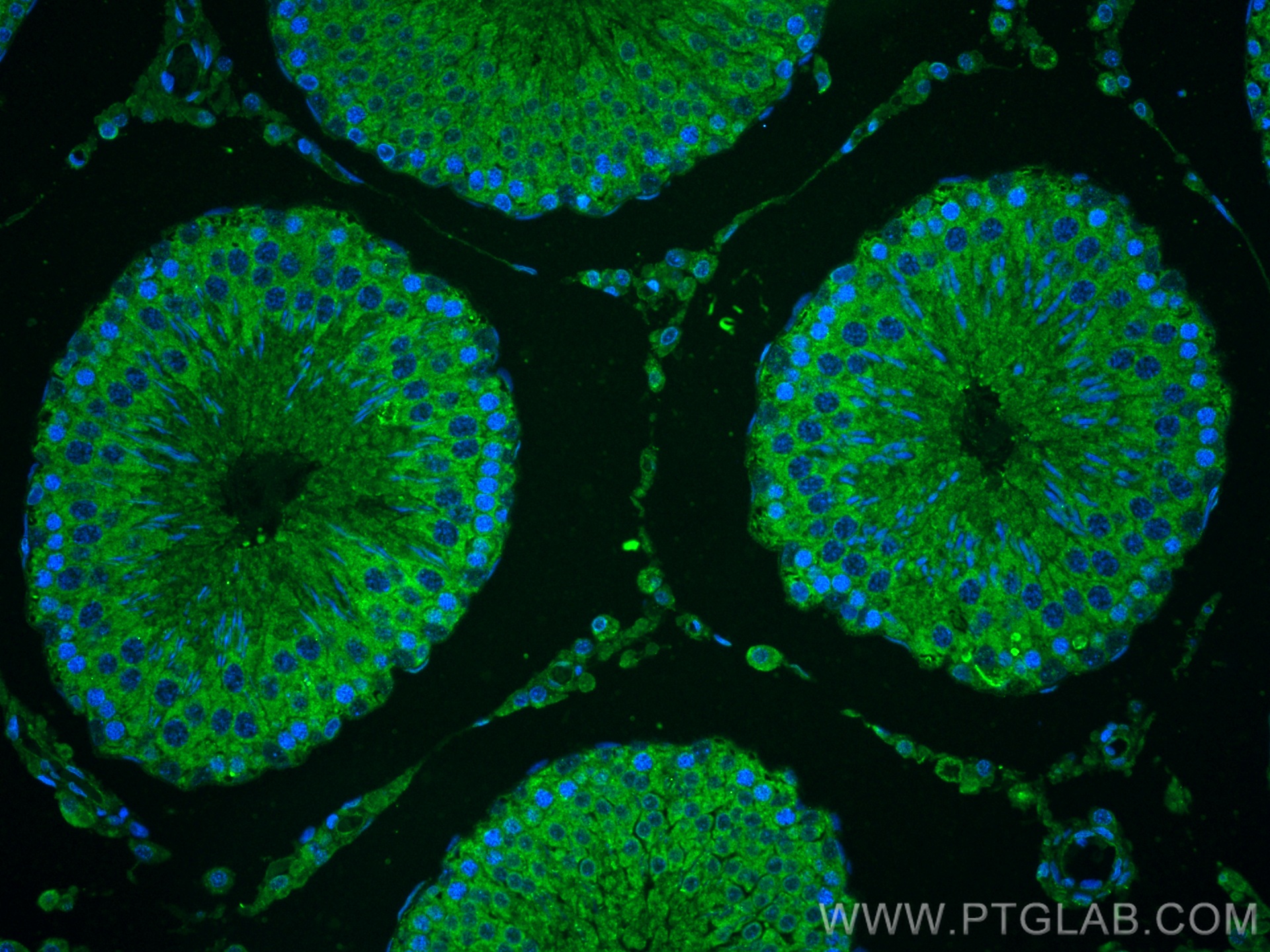 IF Staining of rat testis using 16888-1-AP