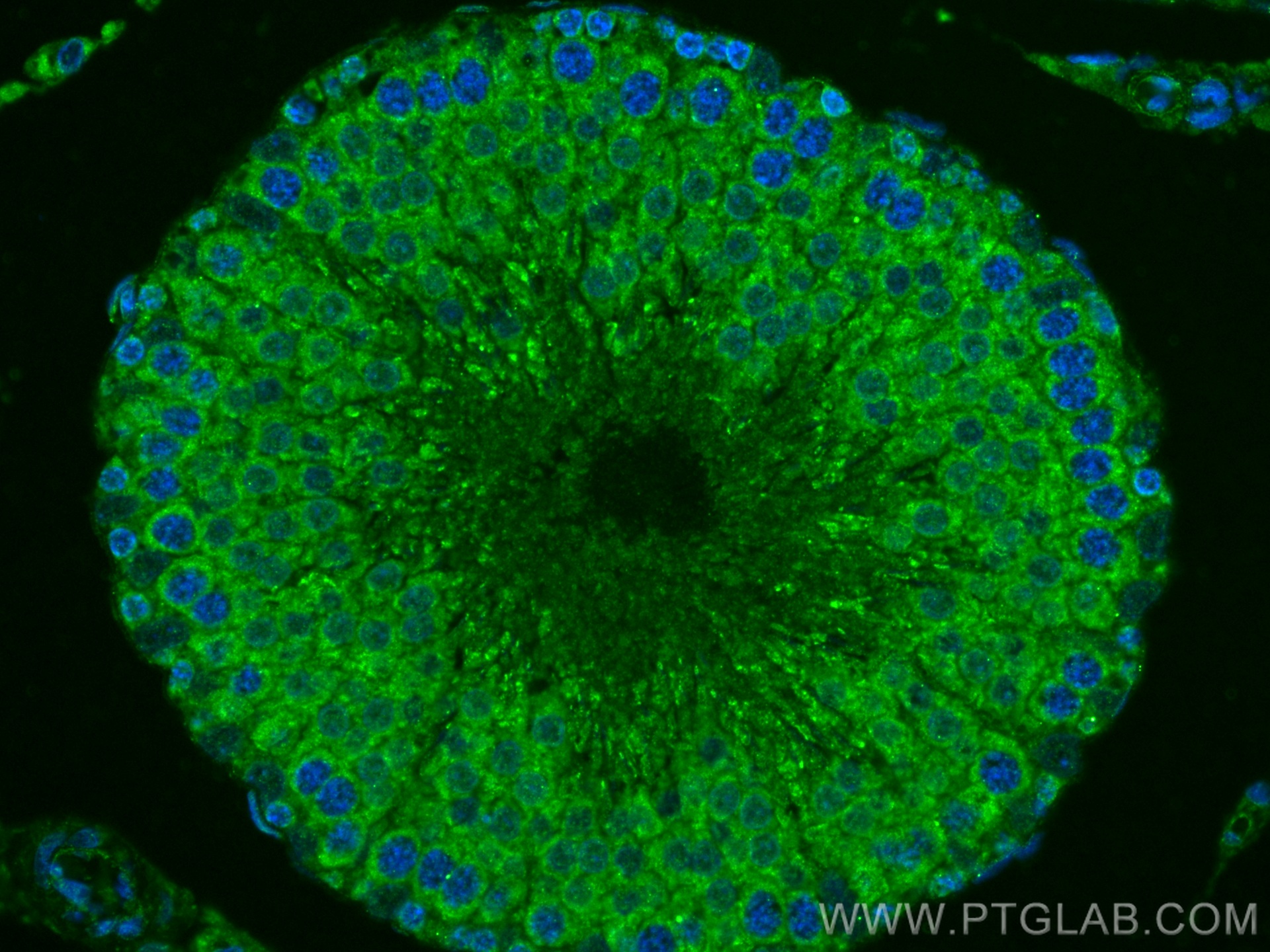 IF Staining of rat testis using 16888-1-AP