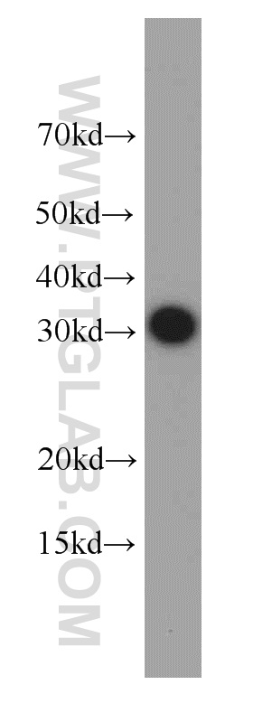 MTCH2 Antibody 16888-1-AP | Proteintech