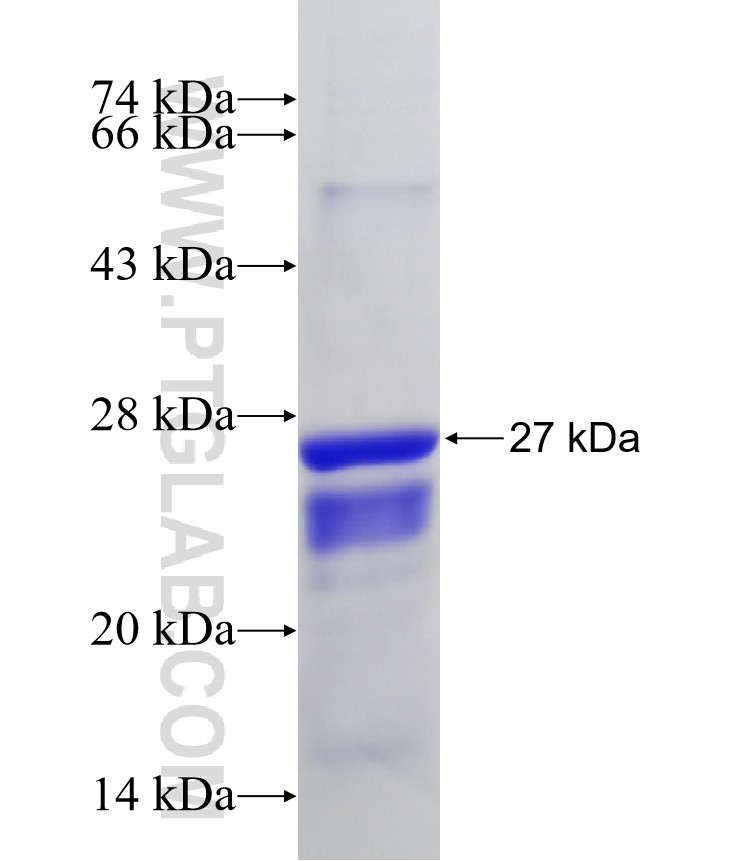 MTCH2 fusion protein Ag10381 SDS-PAGE MTCH2 fusion protein Ag10381 SDS-PAGE