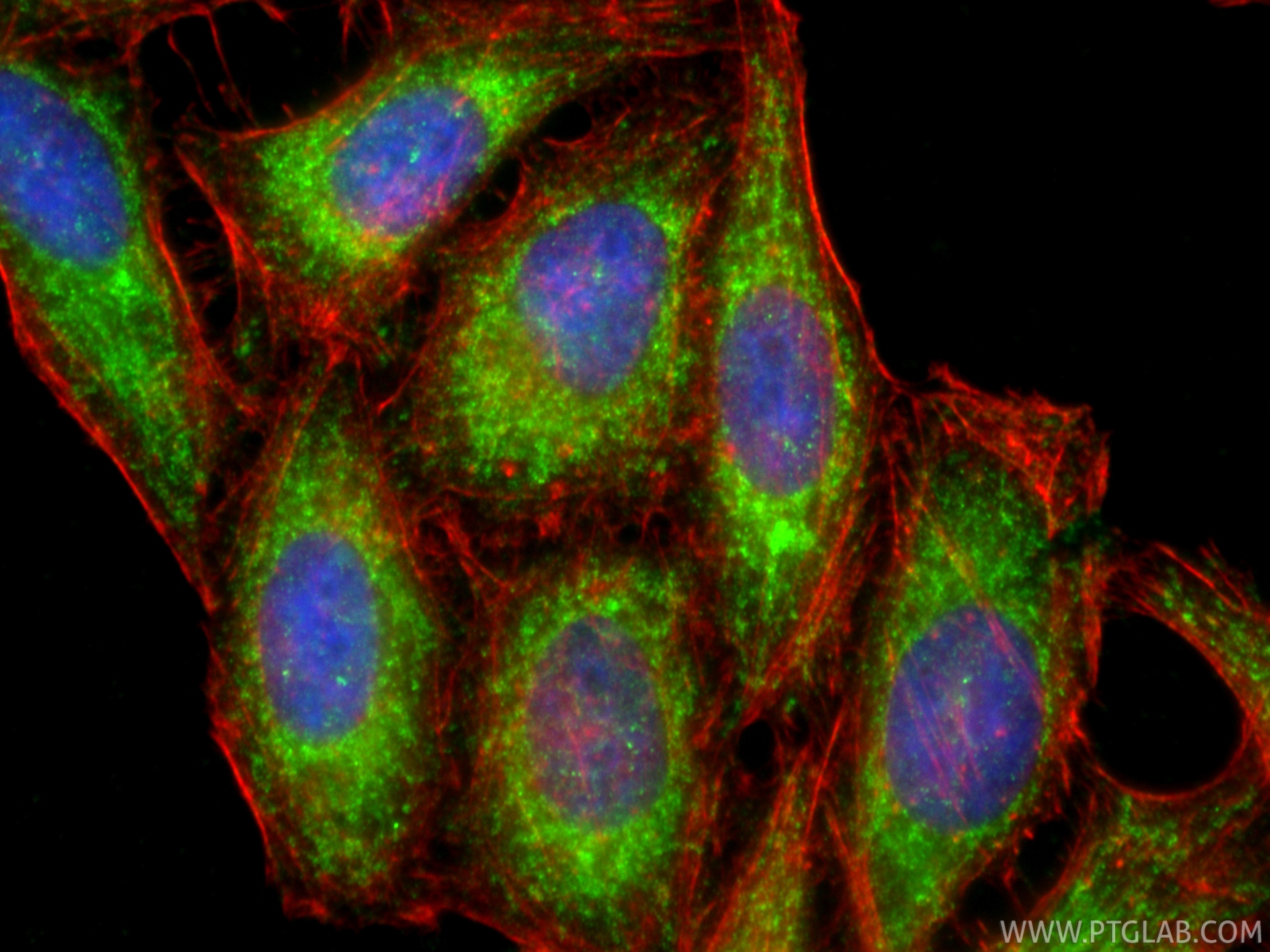 IF Staining of HepG2 using 34285-1-AP