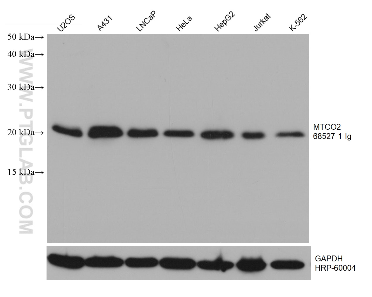 WB analysis using 68527-1-Ig (same clone as 68527-1-PBS)