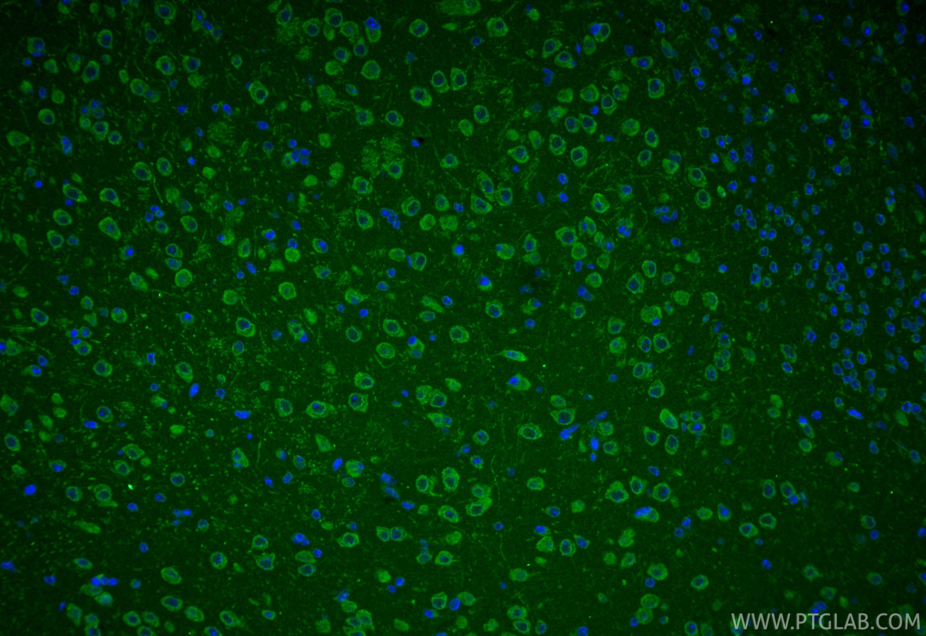 IF Staining of mouse brain using 16957-1-AP IF Staining of mouse brain using 16957-1-AP