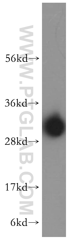 WB analysis of HeLa using 16957-1-AP