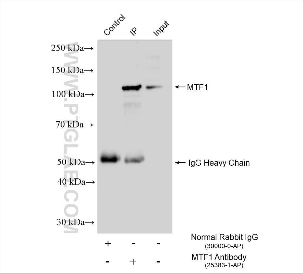 IP experiment of HepG2 using 25383-1-AP