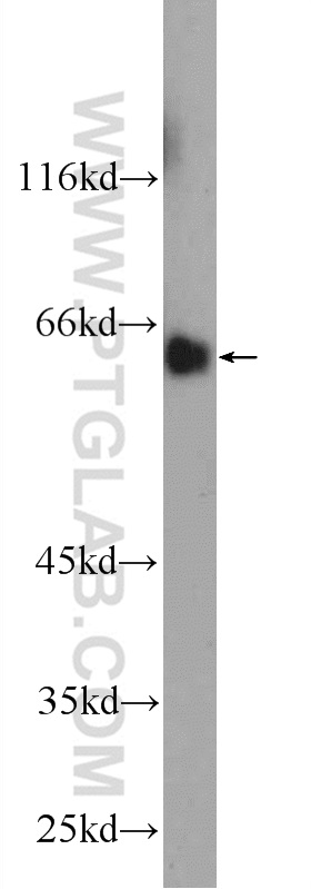 WB analysis of mouse liver using 25383-1-AP