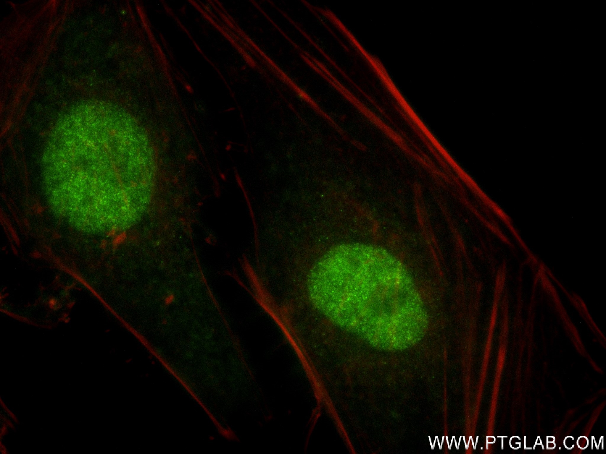 IF Staining of HeLa using 82944-1-RR (same clone as 82944-1-PBS)