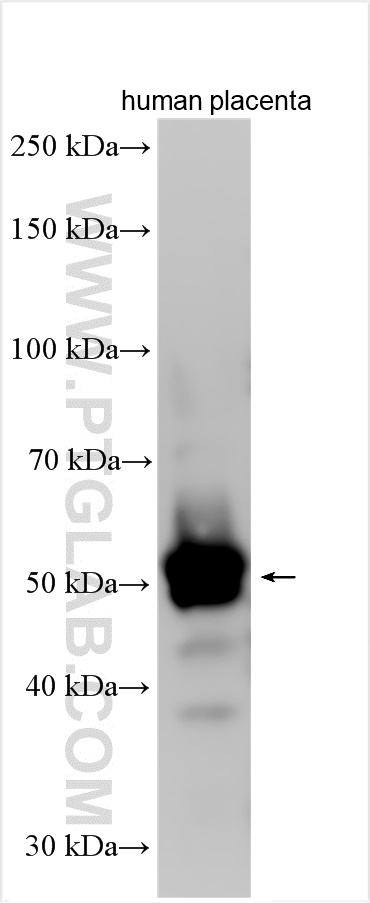 WB analysis using 25854-1-AP