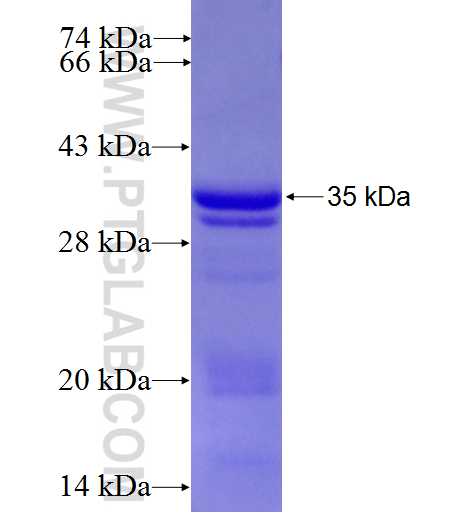 MTG1 fusion protein Ag5397 SDS-PAGE MTG1 fusion protein Ag5397 SDS-PAGE