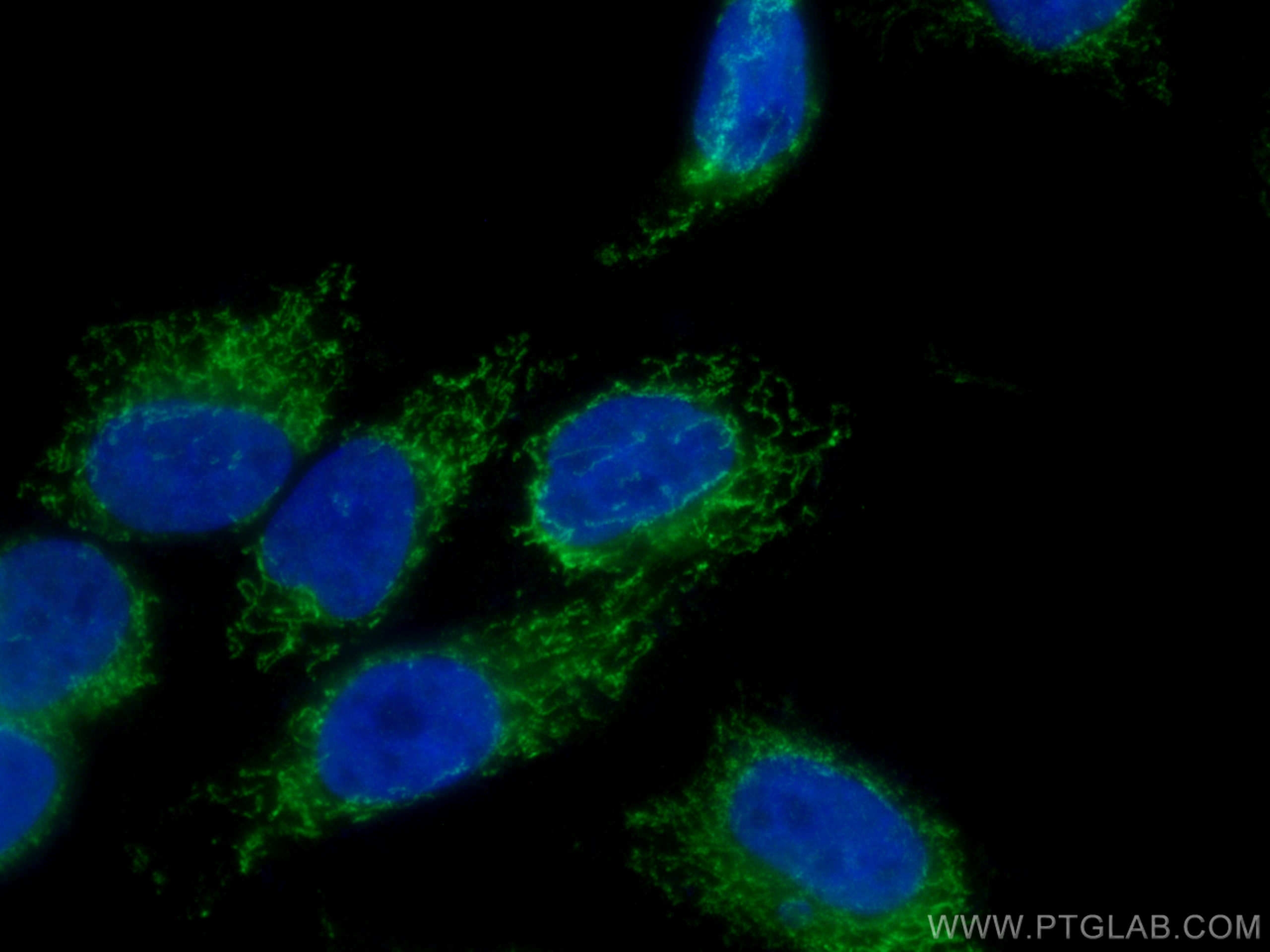 IF Staining of HepG2 using 16113-1-AP