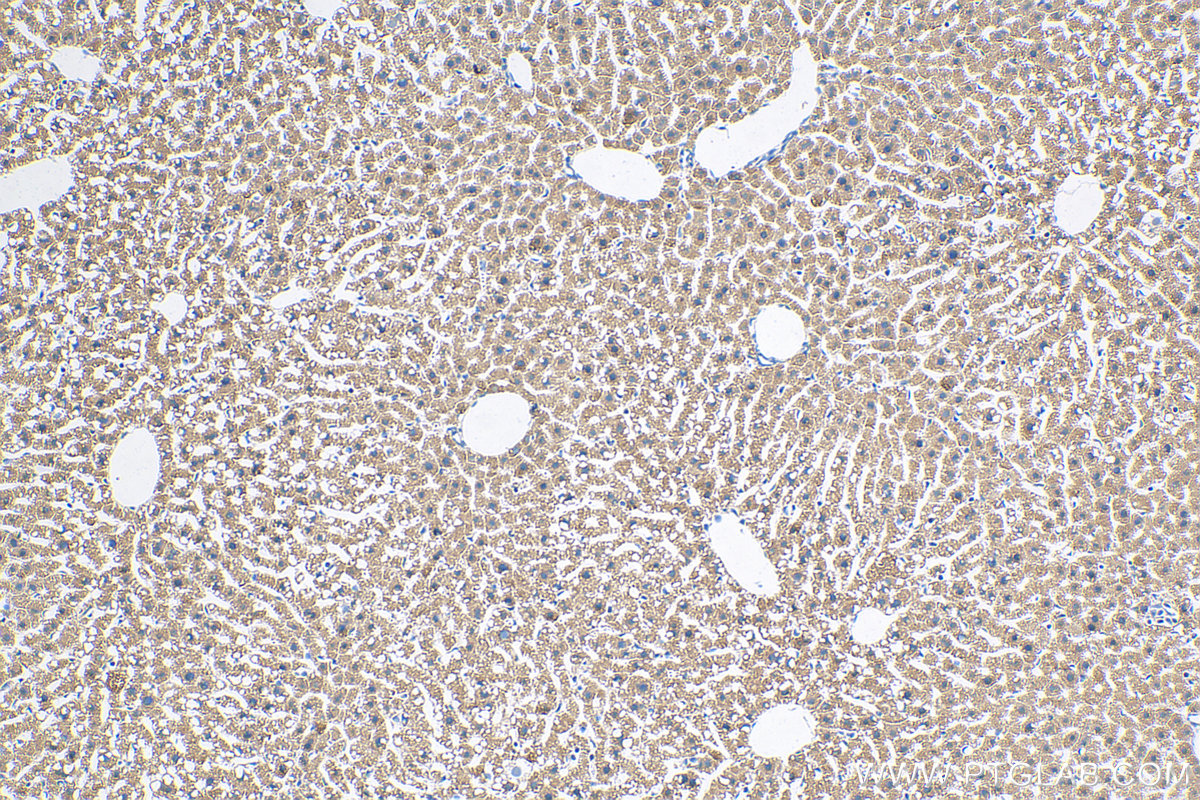 IHC staining of mouse liver using 68321-1-Ig