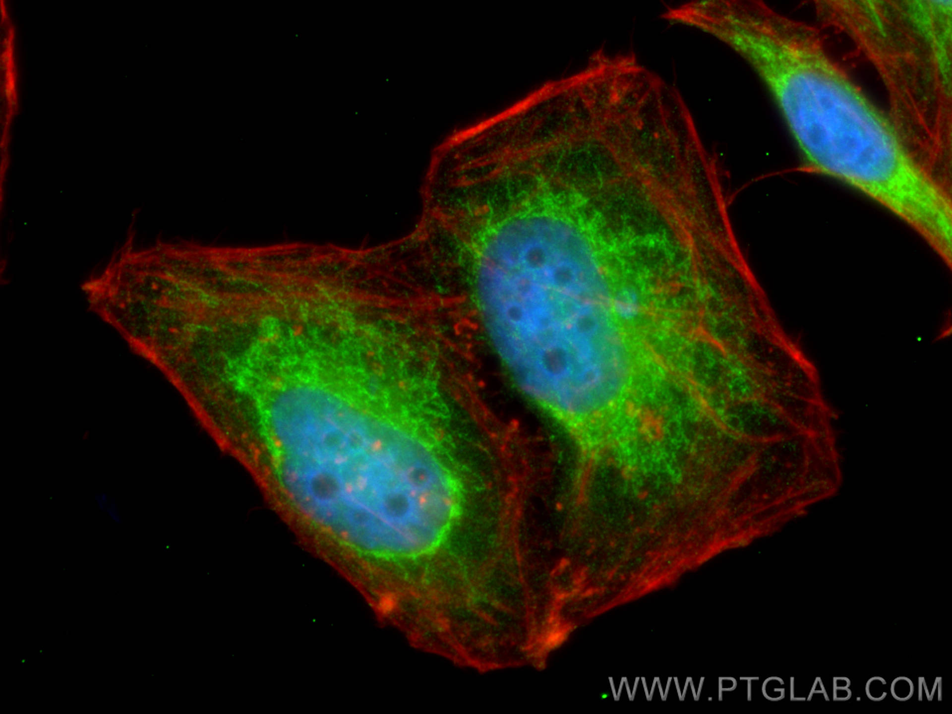 IF Staining of HepG2 using 12270-1-AP