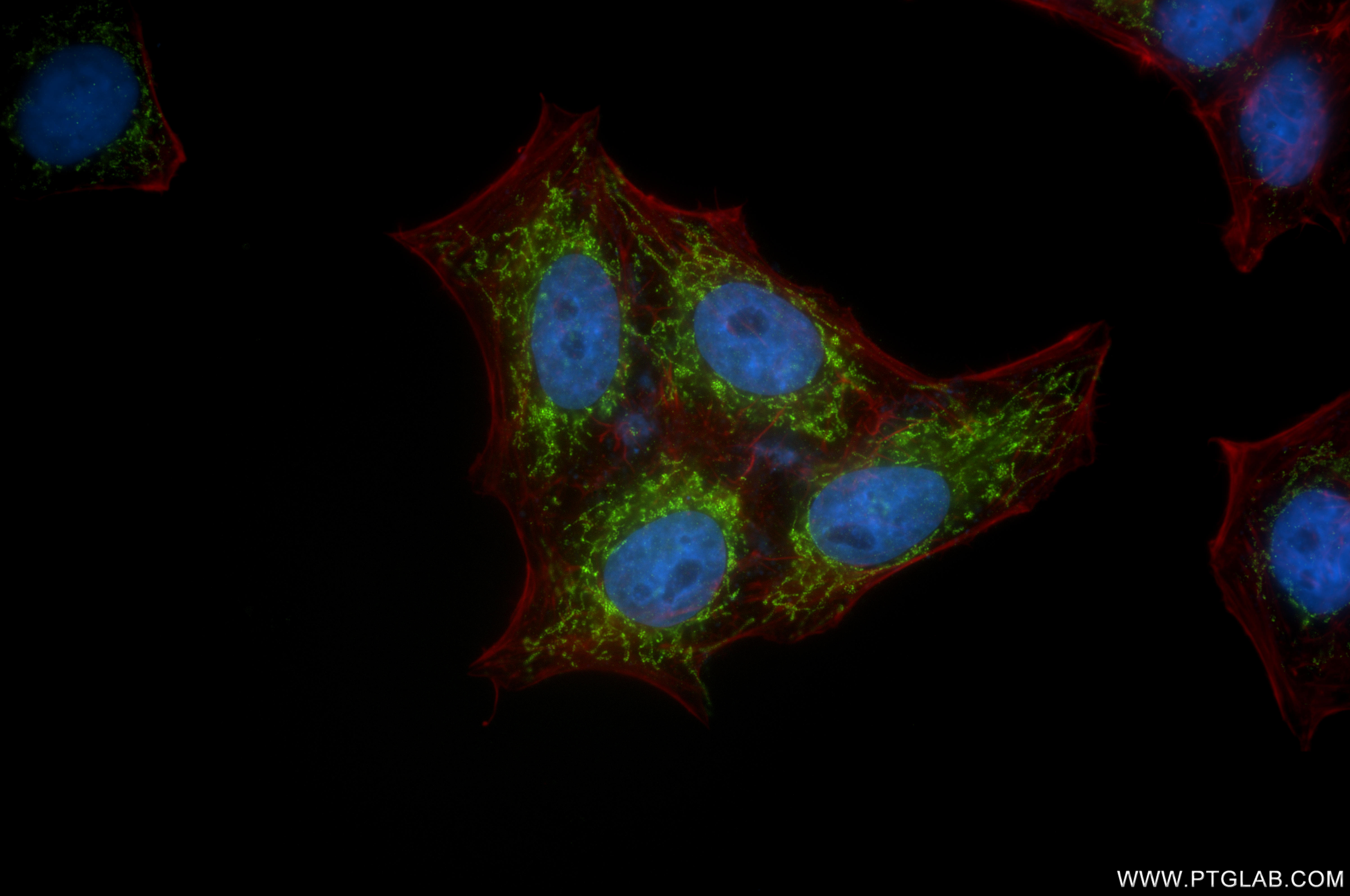 IF Staining of HepG2 using 86608-3-RR IF Staining of HepG2 using 86608-3-RR