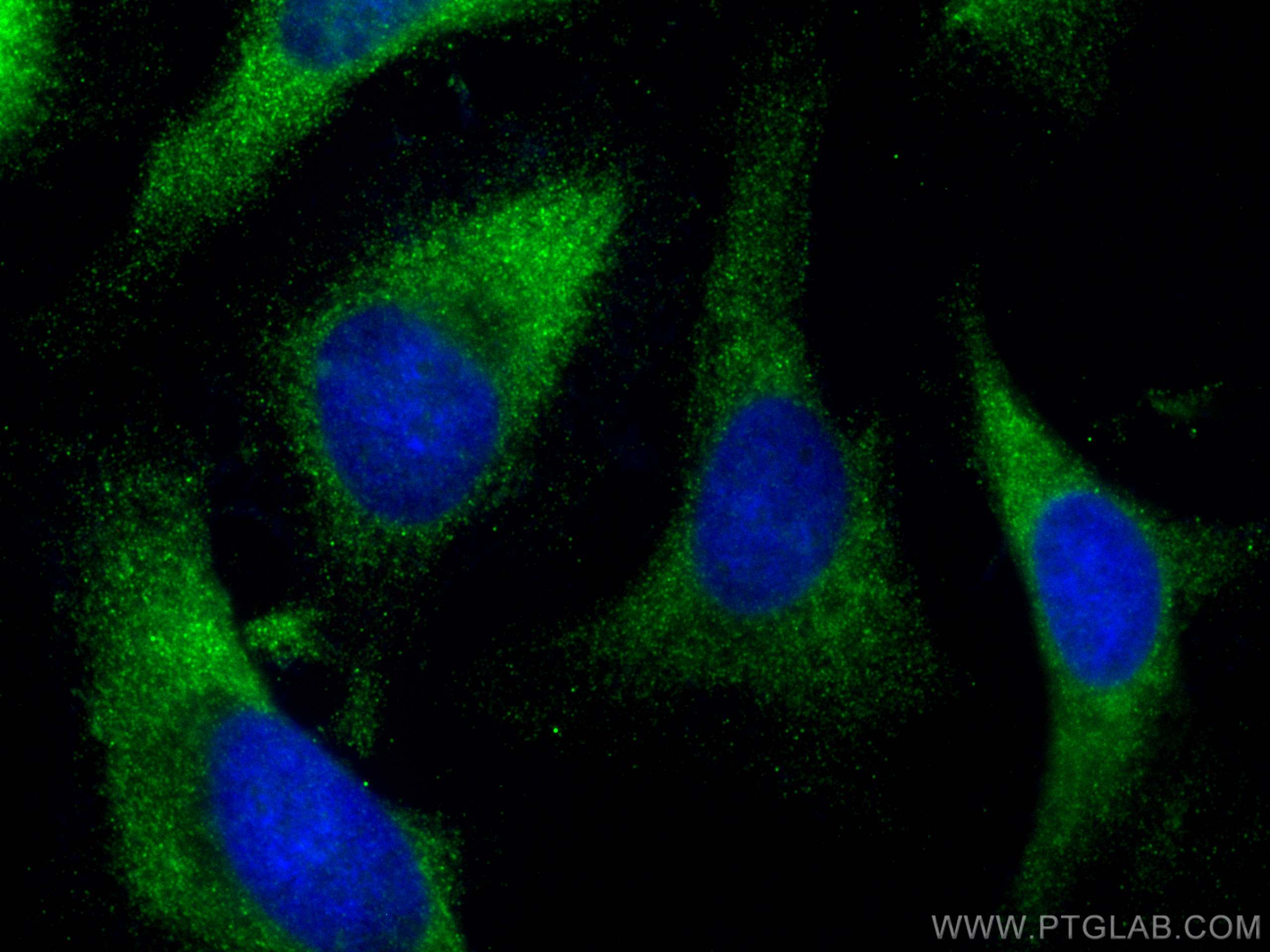 IF Staining of HeLa using 66612-1-Ig