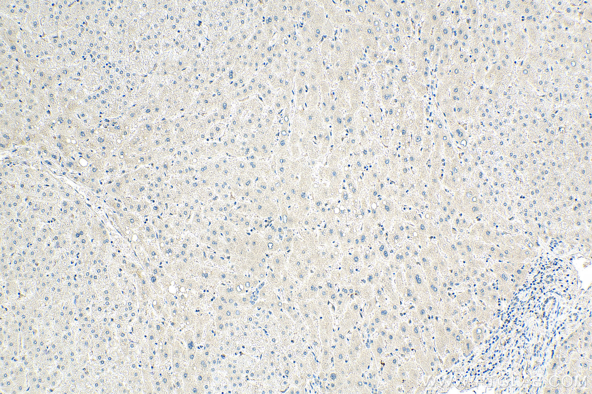 IHC staining of human liver using 66612-1-Ig