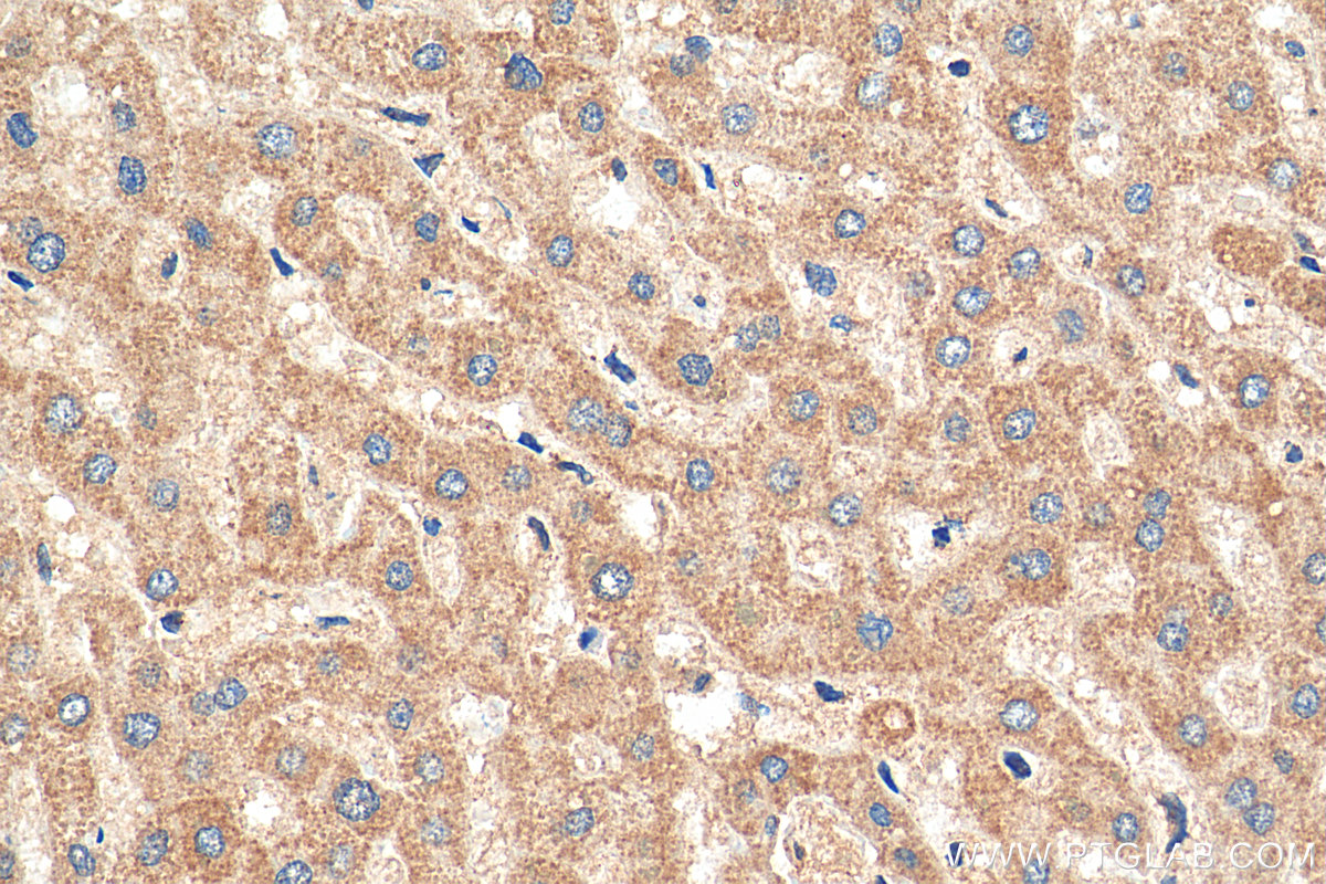 IHC staining of human liver using 14219-1-AP