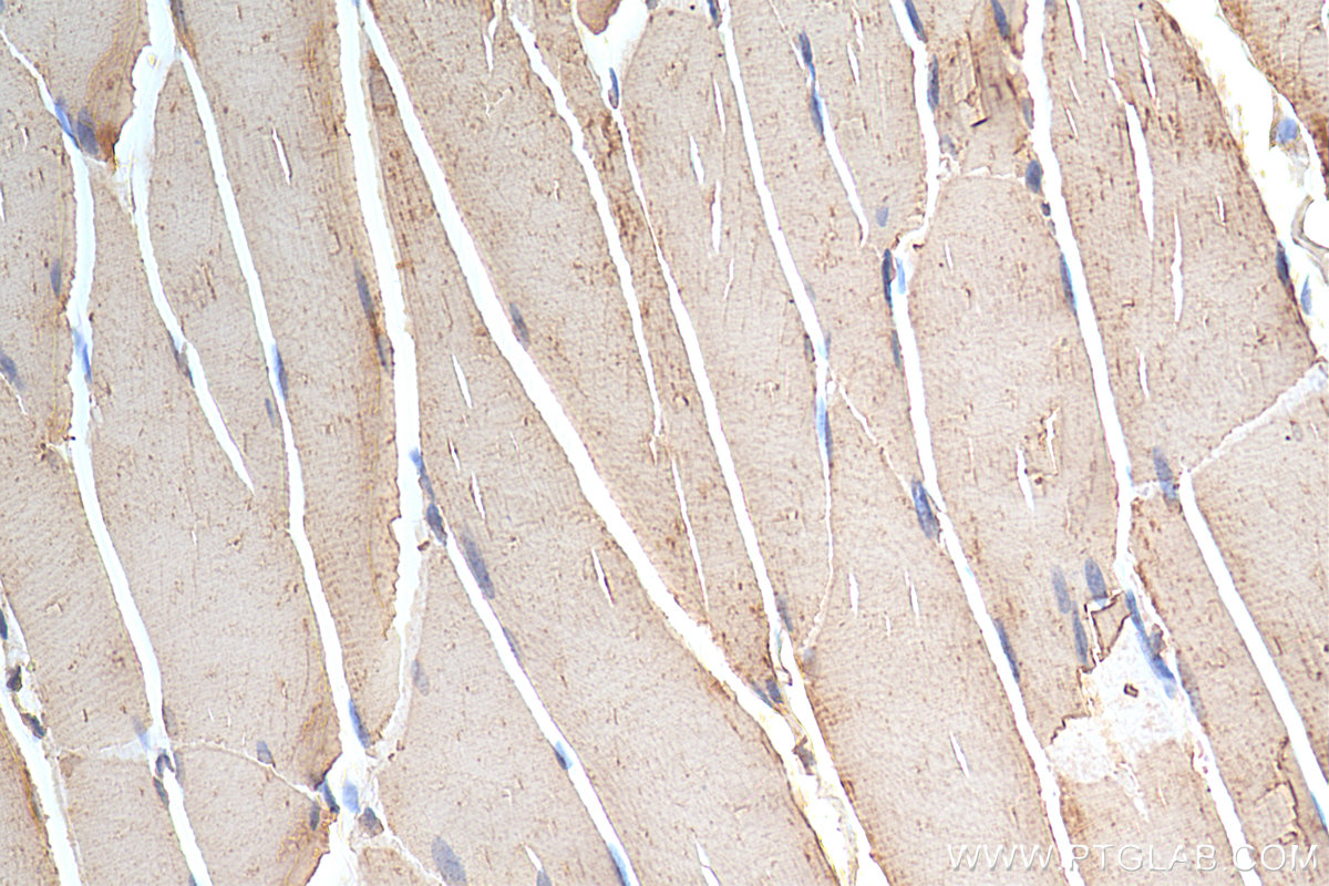 IHC staining of rat skeletal muscle using 13924-1-AP