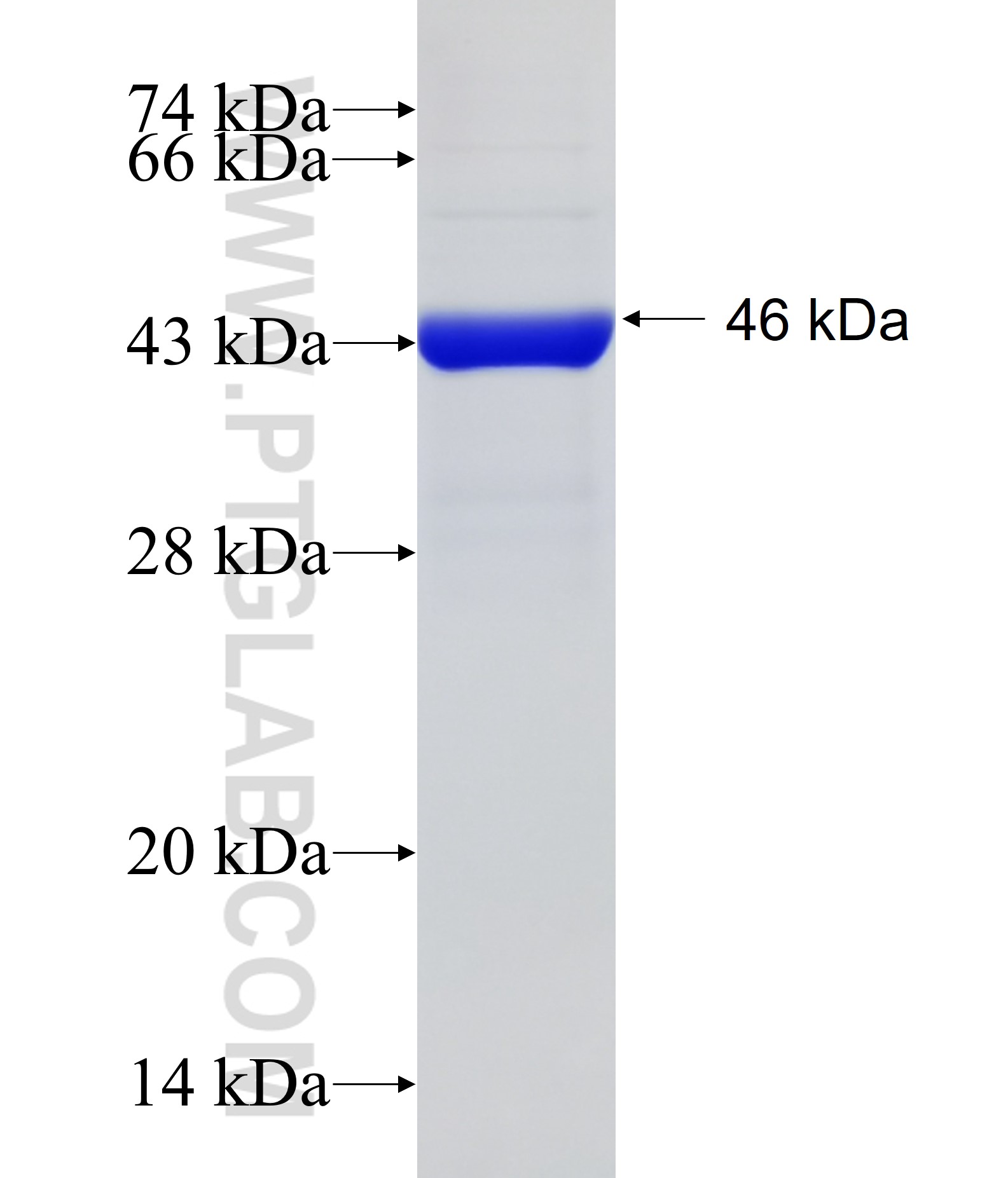 MTM1 fusion protein Ag33059 SDS-PAGE MTM1 fusion protein Ag33059 SDS-PAGE
