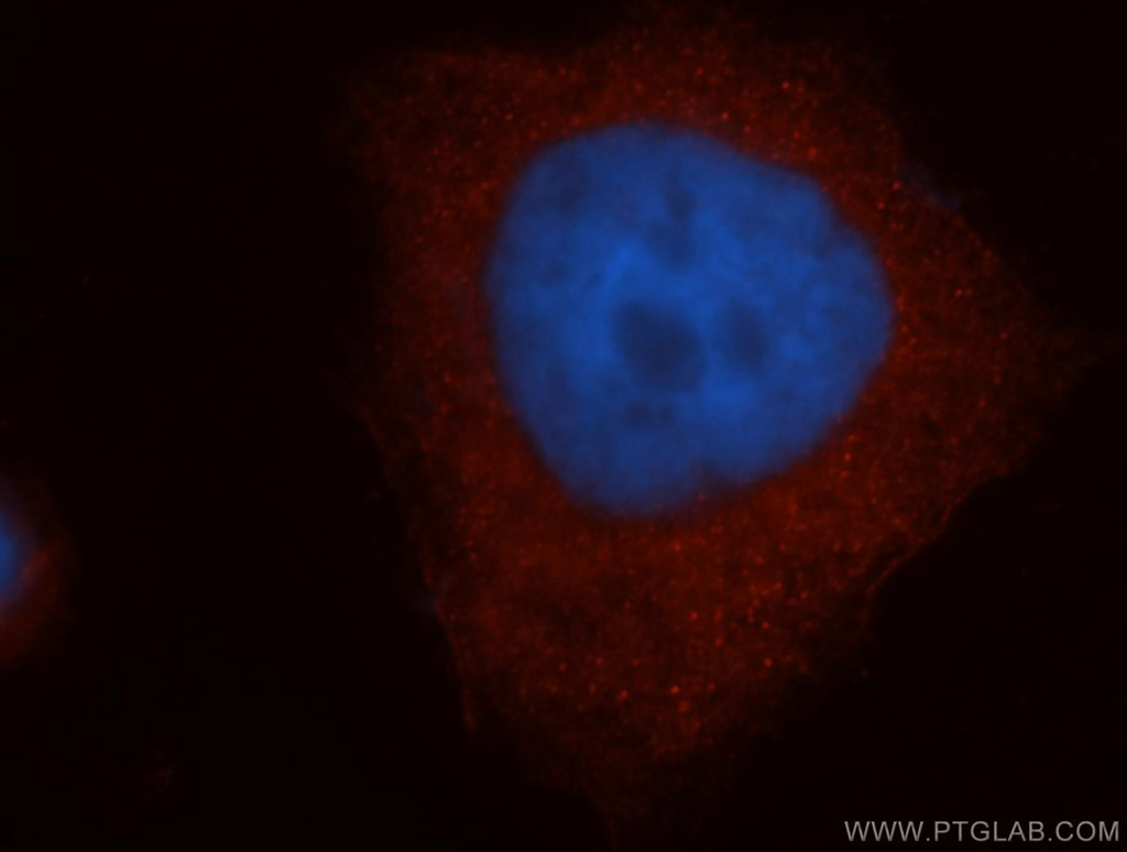 IF Staining of HeLa using 14973-1-AP