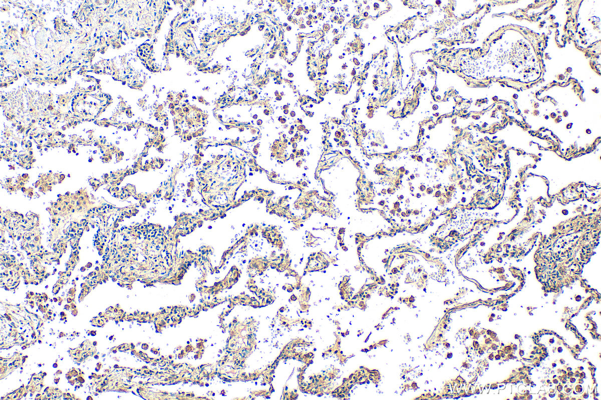 IHC staining of human lung using 14973-1-AP