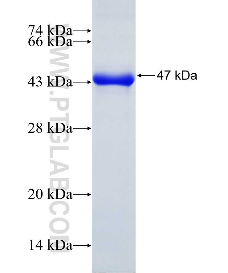 MTMR15 fusion protein Ag11663 SDS-PAGE MTMR15 fusion protein Ag11663 SDS-PAGE