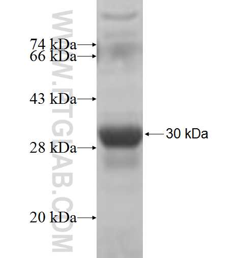 MTMR6 fusion protein Ag5328 SDS-PAGE