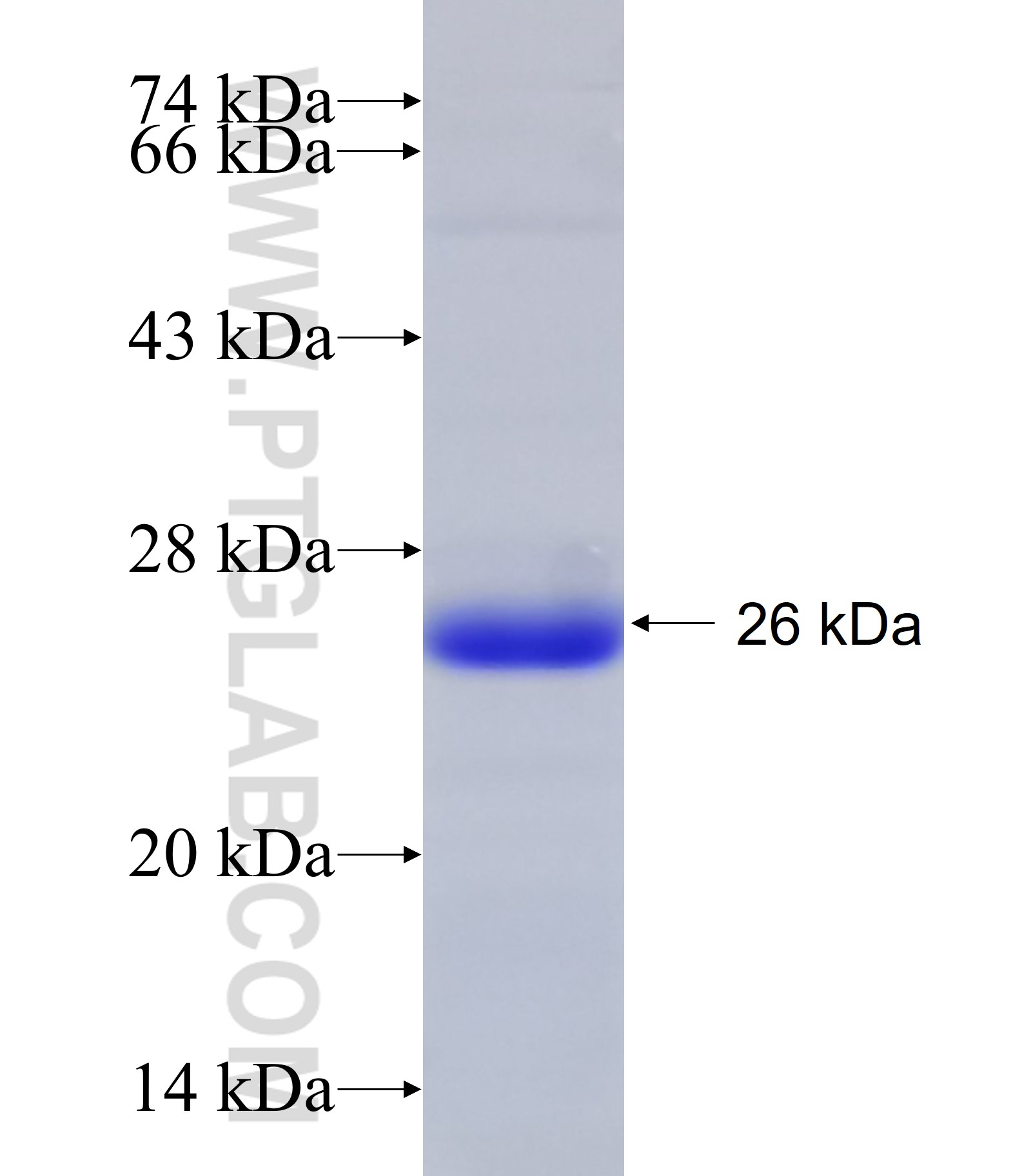 MTMR7 fusion protein Ag23738 SDS-PAGE MTMR7 fusion protein Ag23738 SDS-PAGE