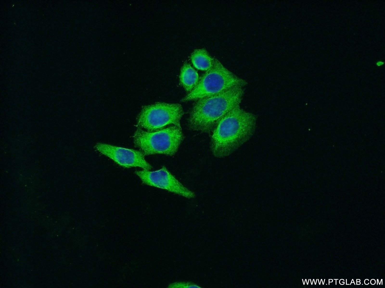 IF Staining of HeLa using 20657-1-AP