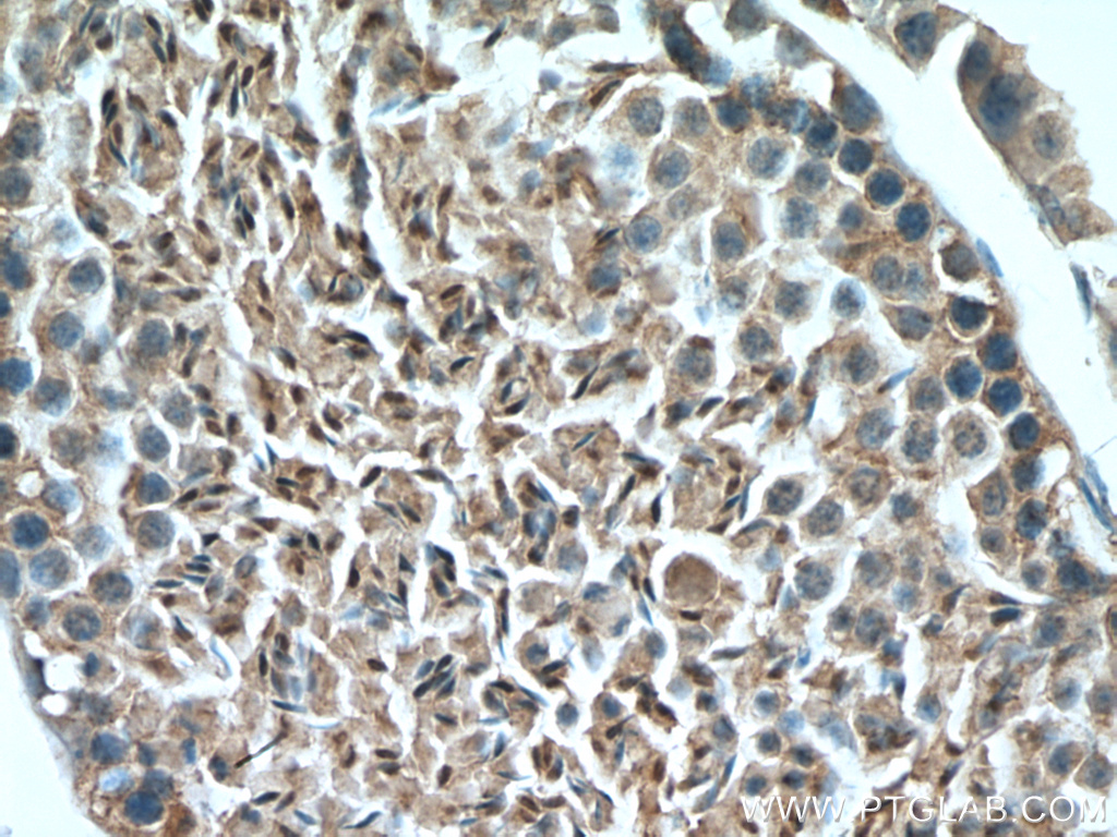 IHC staining of mouse testis using 20657-1-AP