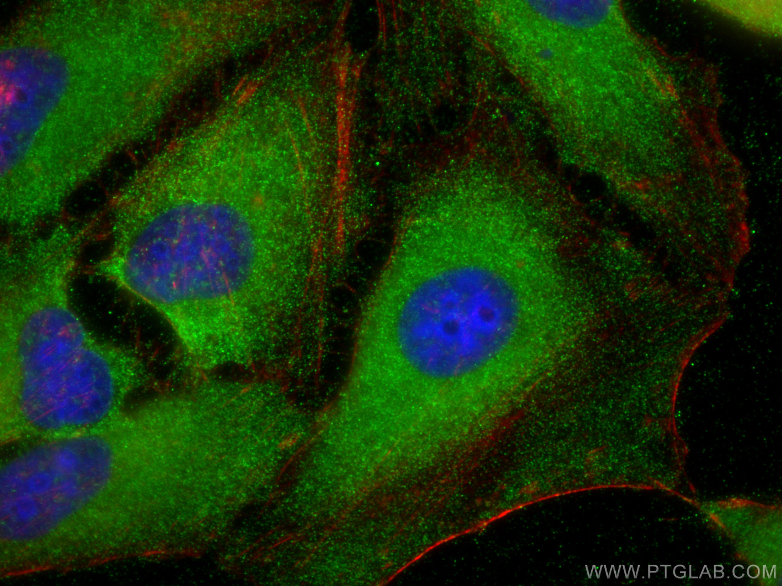 IF Staining of HeLa using 28273-1-AP