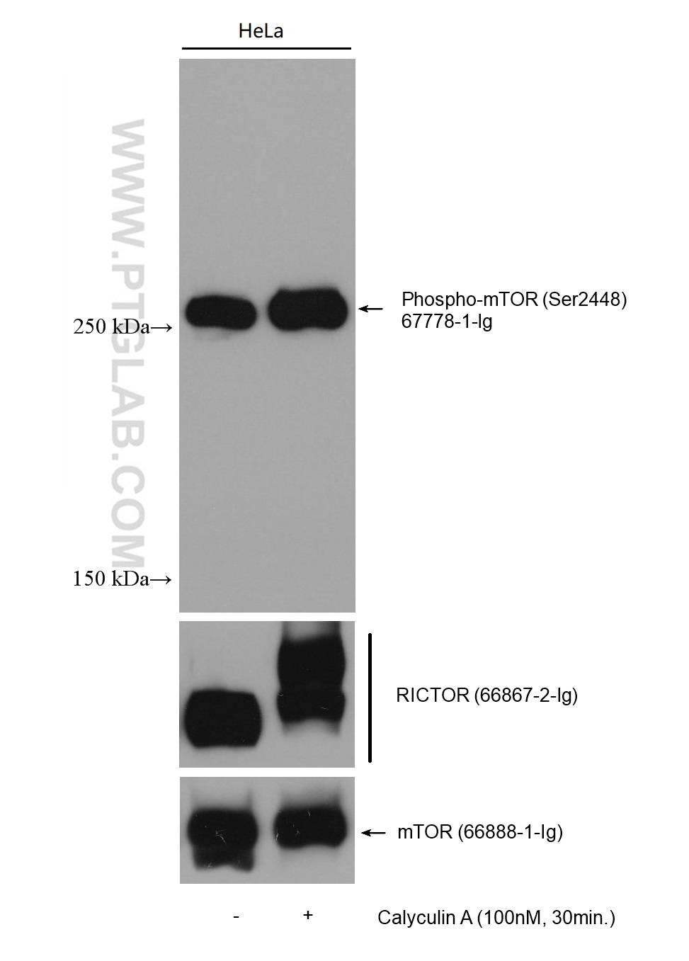 WB analysis of HeLa using 66888-1-Ig