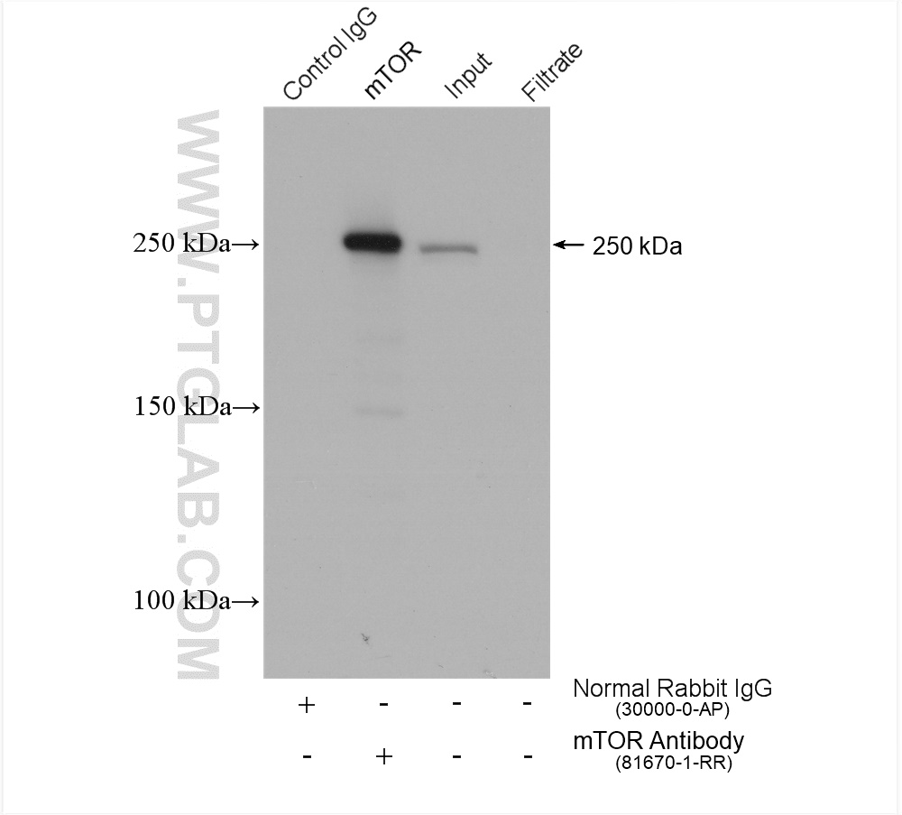 IP experiment of HeLa using 81670-1-RR (same clone as 81670-1-PBS)
